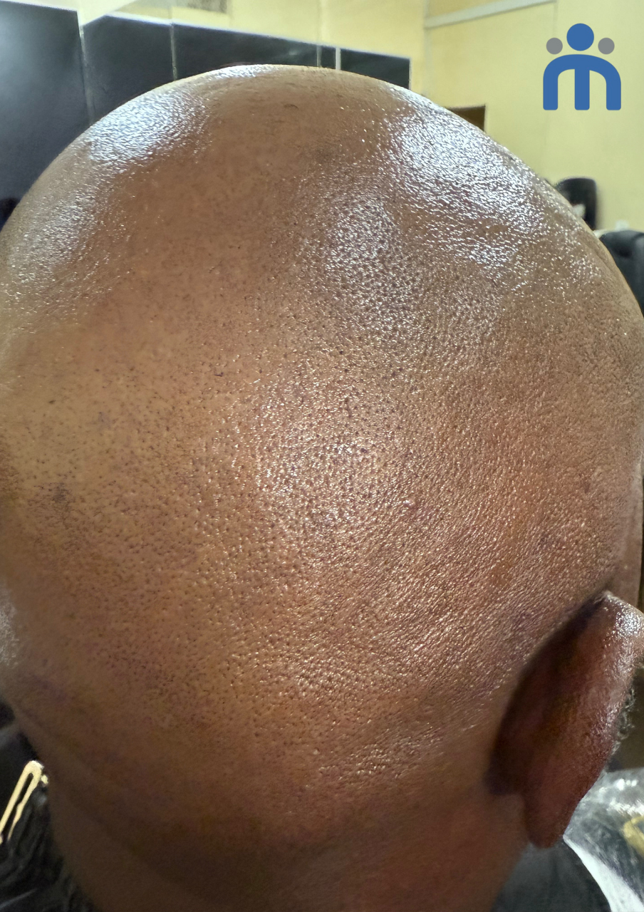 SCALP BALM 100G